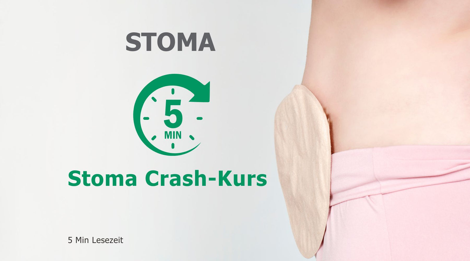Stoma in 5 Minuten verstehen