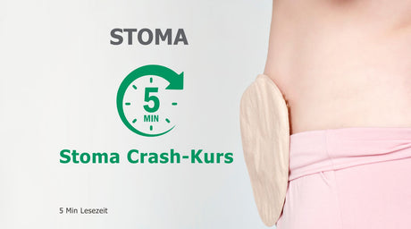Stoma in 5 Minuten verstehen